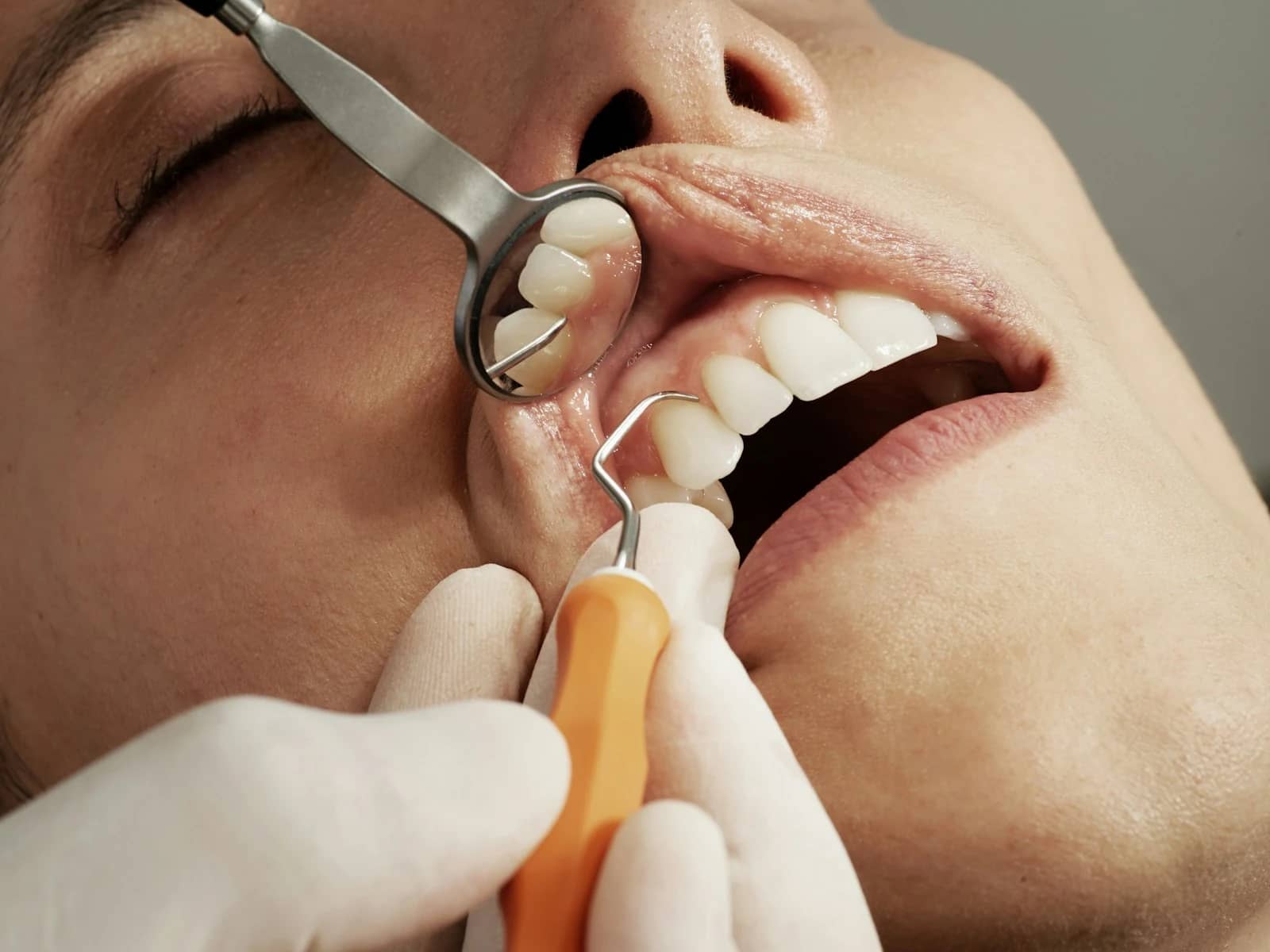 Économiser chez le dentiste avec 5 applis