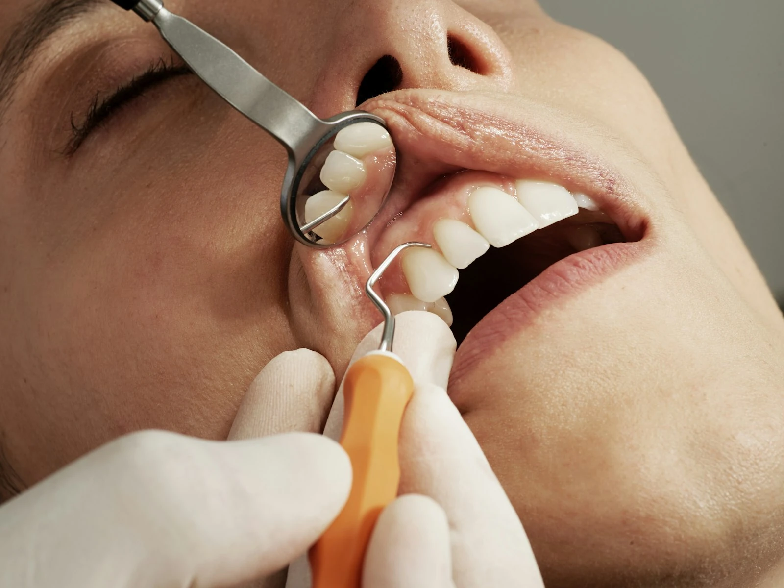 Économiser chez le dentiste avec 5 applis